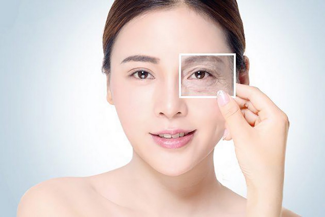 Botox có thể làm nâng cung mày, căng vùng da quanh mắt